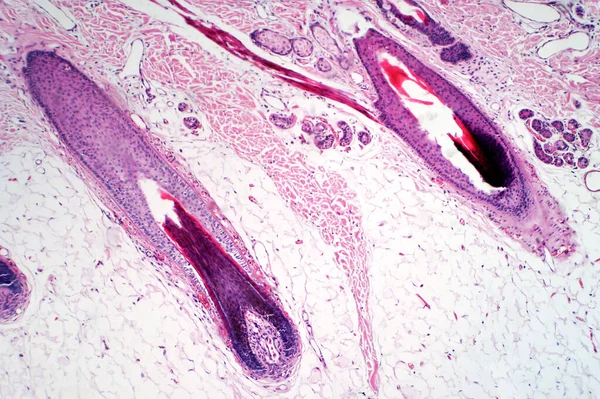人間の頭皮と毛包の軽いマイクログラフ ヘマトキシリン及びエオシン染色技術スライド — ストック写真