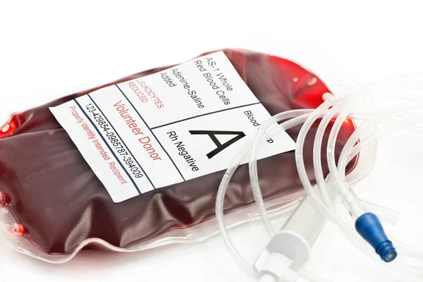 Saco Transfusão Sangue Com Tubo Intravenoso — Fotografia de Stock