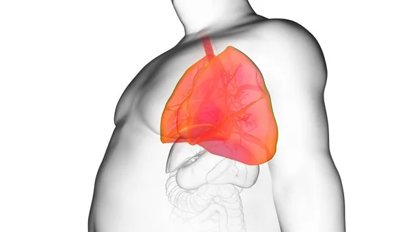 Otyłe Płuco Człowieka Ilustracja — Zdjęcie stockowe