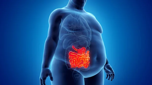 肥満の男の小腸 イラスト — ストック写真