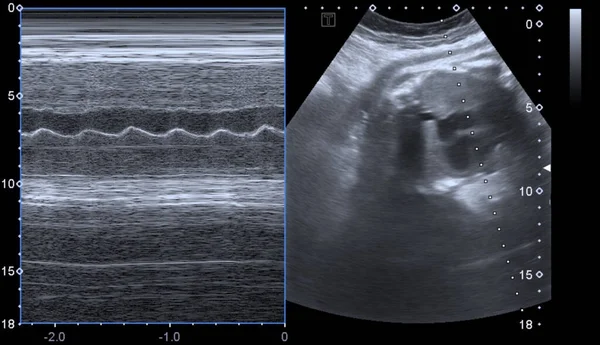 Ultra Som Batimento Cardíaco Bebê — Fotografia de Stock