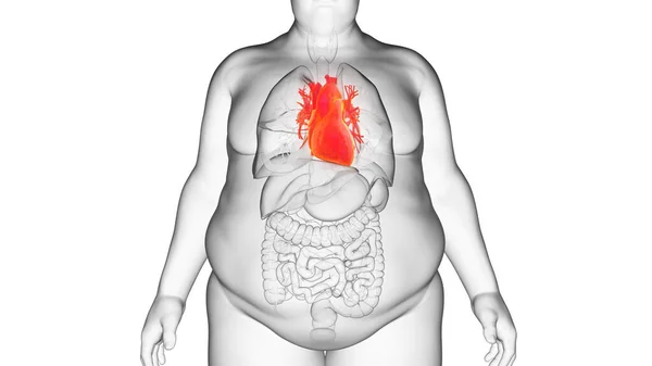 Obese Man Heart Illustration — Stock Photo, Image