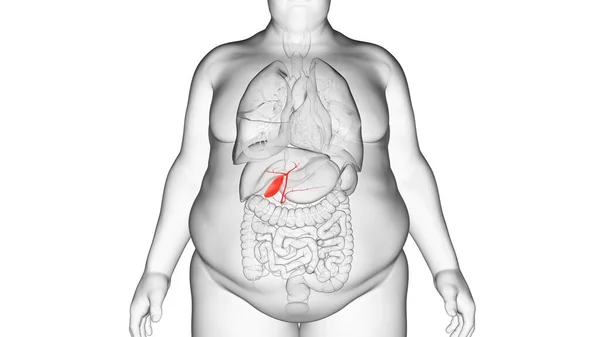 肥満の男の胆嚢 イラスト — ストック写真