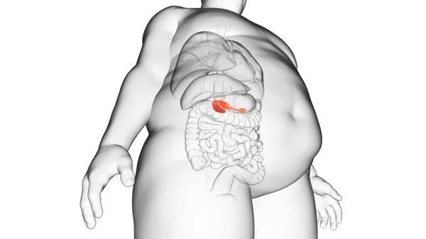 Obese Man Pancreas Illustration — Stock Photo, Image
