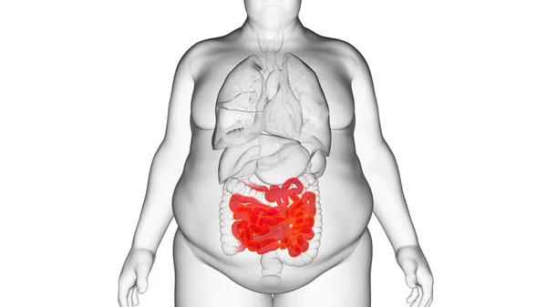 Obese Man Small Intestine Illustration — Stock Photo, Image