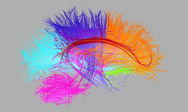 Illustratie Van Zenuwbanen Menselijke Hersenen Basis Van Mri Gegevens Magnetic — Stockfoto