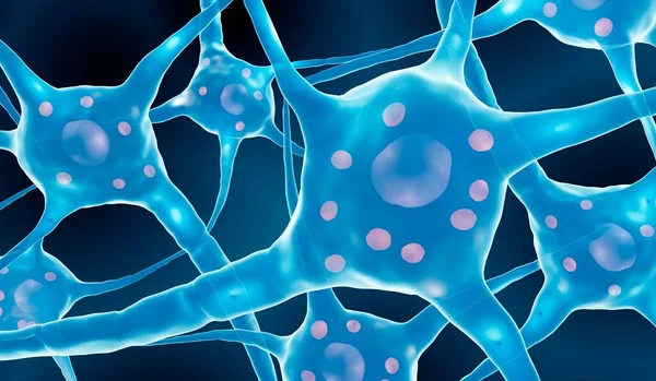 神経細胞におけるルイス体のイラスト ルイス ボディはパーキンソン病の神経細胞内で発生するタンパク質の蓄積である — ストック写真