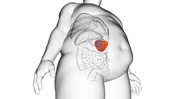 Obese Man Spleen Illustration — Stock Photo, Image