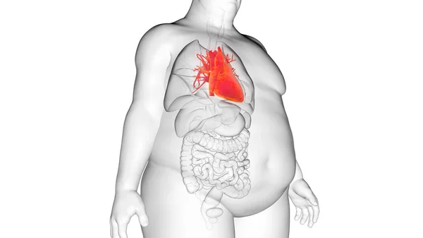Das Herz Des Fettleibigen Mannes Illustration — Stockfoto