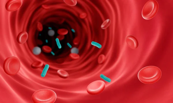 Kan Dolaşımında Kan Zehirlenmesine Neden Olan Bakteri Çizimi — Stok fotoğraf