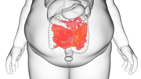 Obese Man Small Intestine Illustration — Stock Photo, Image