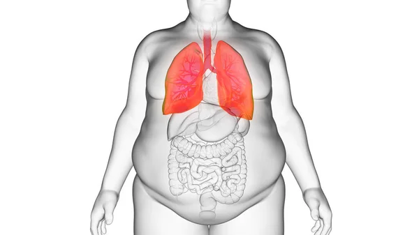 Πνεύμονας Του Παχύσαρκου Ανθρώπου Απεικόνιση — Φωτογραφία Αρχείου