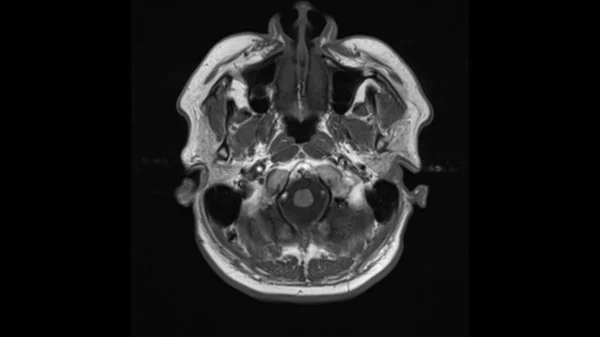 Здоровая Голова Магнитно Резонансная Томография Мрт Передняя Часть Головы Сверху — стоковое фото