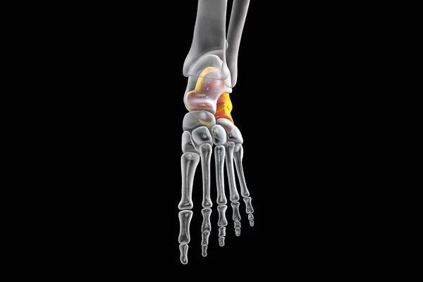 Illustration Calcaneus Heel Bone Foot — Stock Photo, Image