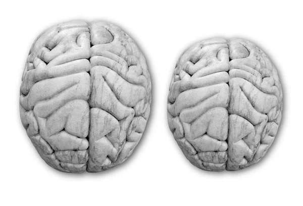 Snížení Objemu Mozku Infekci Covid Ilustrace — Stock fotografie