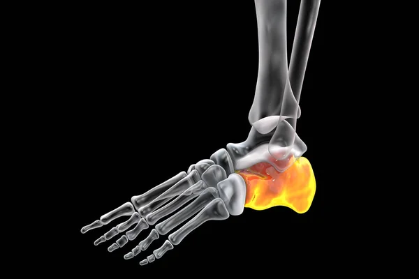 Illustration Calcaneus Heel Bone Foot — Stock Photo, Image