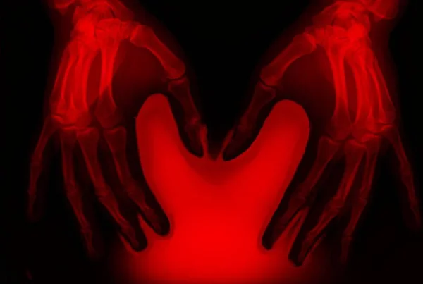 Menselijke Handen Gekleurde Röntgenfoto — Stockfoto