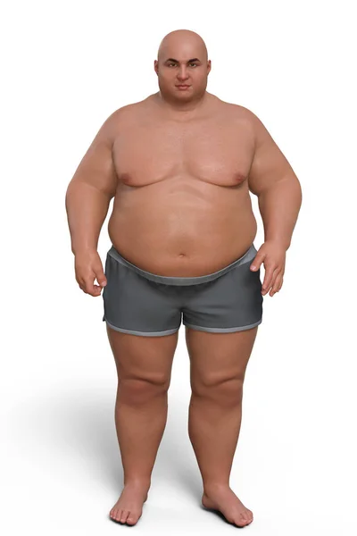 Lihava Mies Seisoo Tietokonekuva Jossa Korostetaan Lihavuuden Mahdollisten Käyttäytymisongelmien Psyykkisten — kuvapankkivalokuva
