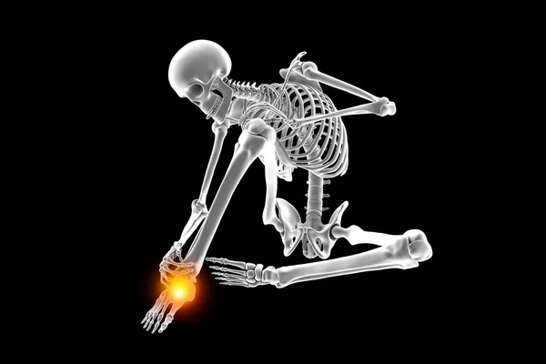 足首の痛みが原因で人の骨格が座って足首を保持するイラスト 筋骨格系と足首に関連する潜在的な傷害を強調 — ストック写真