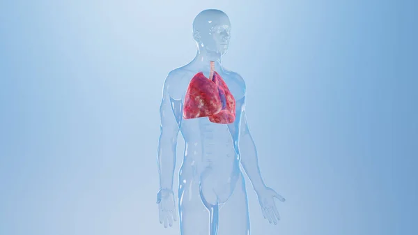 Zapalenie Płuc Ilustracja — Zdjęcie stockowe