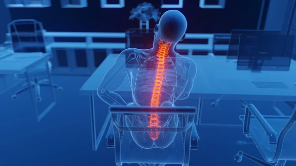 Біль Спині Роботі Ілюстрація — стокове фото