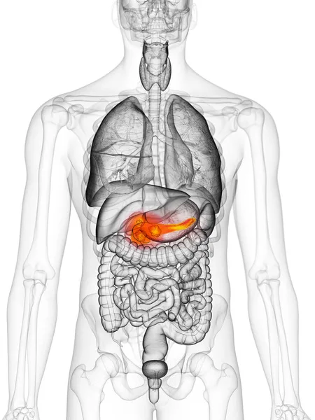Bauchspeicheldrüsenkrebs Illustration Auf Weißem Hintergrund — Stockfoto