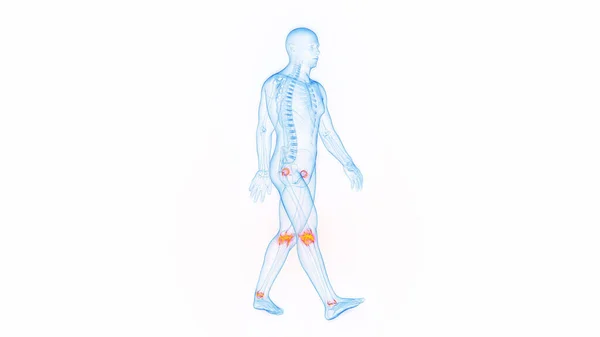 歩いている間の関節痛 イラスト — ストック写真