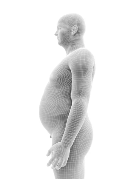 Elhízott Férfi Test Illusztráció — Stock Fotó