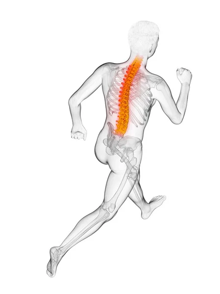 Runner Painful Back Illustration — Stock Photo, Image