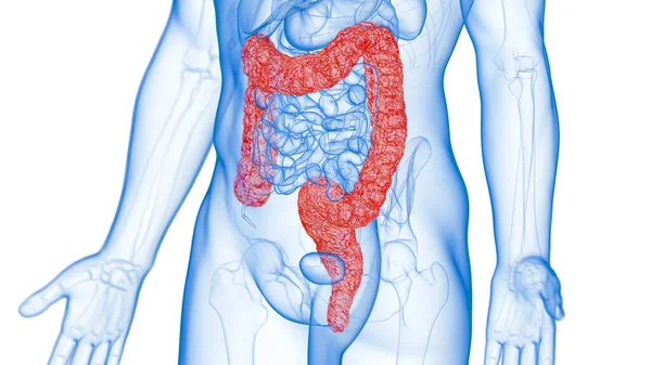 Inflamed Colon Illustration Background — Stock Photo, Image