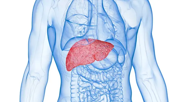 炎症した肝臓のイラスト — ストック写真
