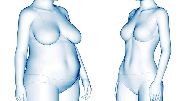 Female Body Transformation Illustration — Stock Photo, Image