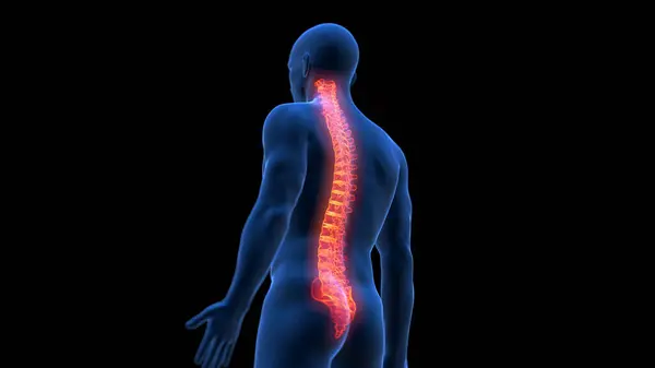 痛苦的人类脊椎 — 图库照片