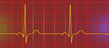 Elektrokardiyogramın (EKG) sağlıklı bir bireyde normal bir kalp atışı ritmi göstermesi..