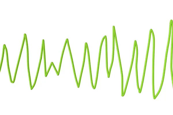 Torsades 'in ritmini gösteren elektrokardiyogramın (EKG) çizimi. 