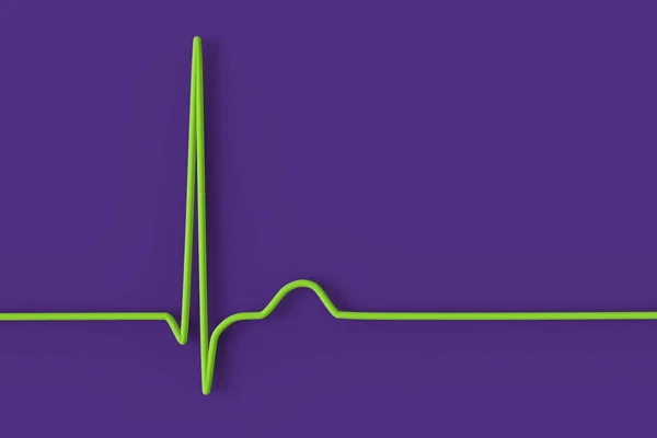 Illustration Electrocardiogram Ecg Displaying Junctional Rhythm Heartbeat Abnormal Rhythm Occurs — Stock Photo, Image