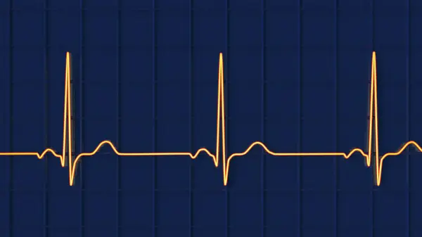 Ilustração Eletrocardiograma Ecg Exibindo Ritmo Cardíaco Normal Indivíduo Saudável — Fotografia de Stock