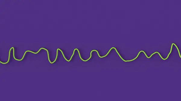 Illustration Electrocardiogram Ecg Displaying Chaotic Rhythm Ventricular Fibrillation Life Threatening — Stock Photo, Image