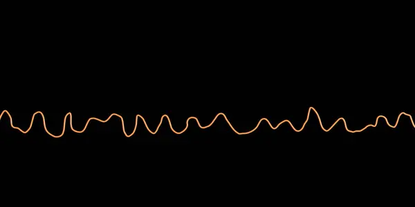 心房細動の混沌としたリズム 心不整脈を脅かす生命を示す電気図 Ecg のイラスト — ストック写真