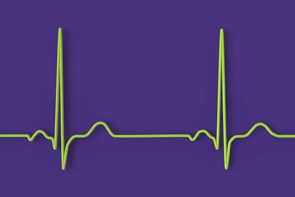 健康な個体に正常な心拍リズムを表示する電気心臓図 Ecg のイラスト — ストック写真