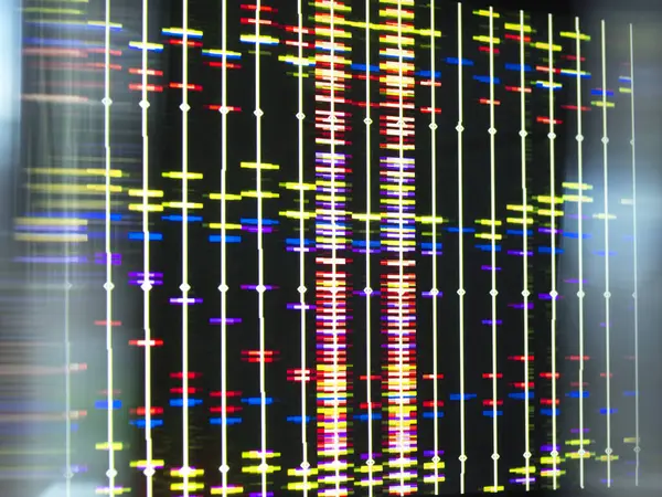 DNA (deoxyribonucleic acid) research, conceptual image. View of a DNA (deoxyribonucleic acid) profile on a screen.