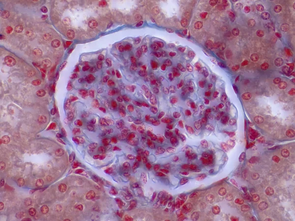 Human kidney, light micrograph.