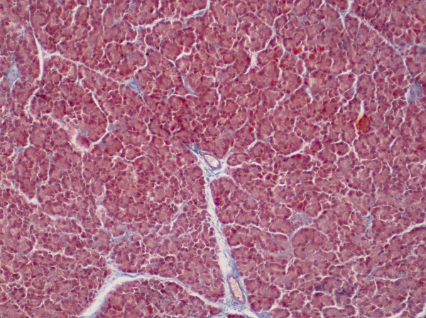 Human liver tissue, light micrograph.