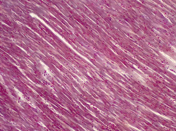 Músculo Cardíaco Humano Micrografia Luz — Fotografia de Stock