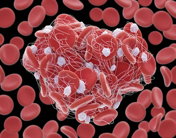 Ilustração Glóbulos Vermelhos Eritrócitos Presos Numa Malha Fibrina Branca Formando — Fotografia de Stock