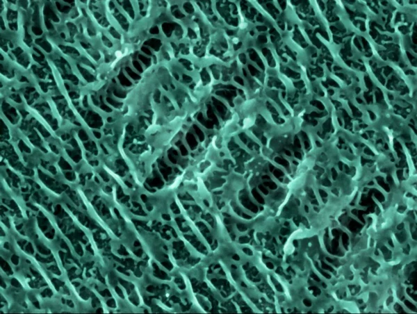镍上的纳米线激光脉冲在镍表面形成的纳米线结构的彩色扫描电子显微镜 Sem — 图库照片