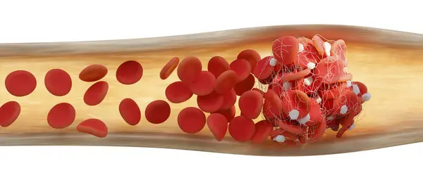 赤血球 白血球 を繊維状の網に閉じ込められた血管のイラスト 線維の生産は血管が損傷したときに活性化される血小板と呼ばれる細胞によって引き起こされます — ストック写真