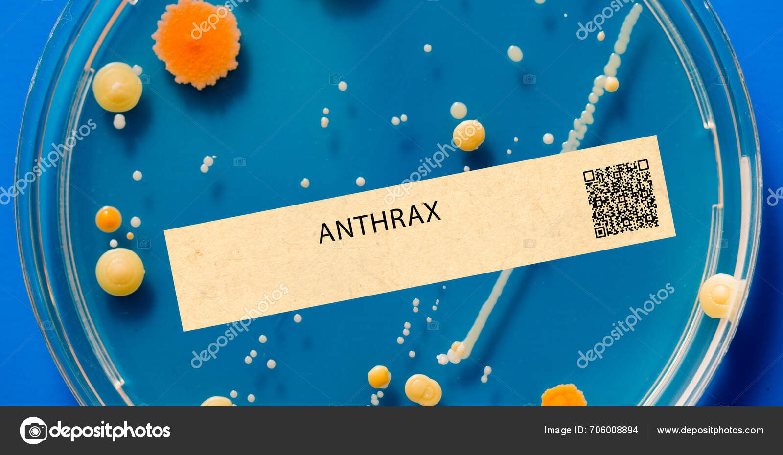 Anthrax Bacterial Infection Can Affect Skin Lungs Digestive System ...