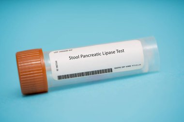 Stool pancreatic lipase test. This test measures the level of pancreatic lipase, an enzyme produced by the pancreas, in the stool. clipart