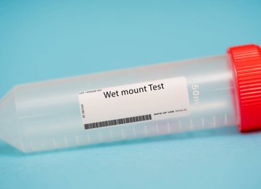 Wet mount test. The wet mount test is a diagnostic test that is used to identify the presence of bacterial vaginosis, yeast infections, or other vaginal infections. clipart